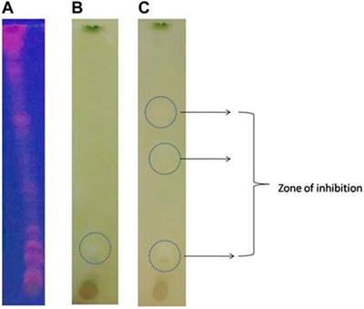 In vitro evaluation of the neuroprotective potential of Olea dioica against Aβ peptide-induced toxicity in human neuroblastoma SH-SY5Y cells